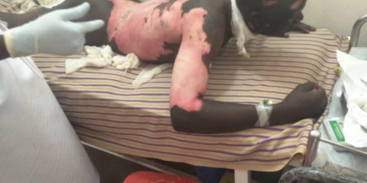 Two Male Sunbelt Factory Jinja Casual Laborers Electrocuted, Company abandons them in private clinic