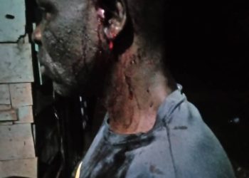 Radio presenter attacked by panga panga-wielding gangsters