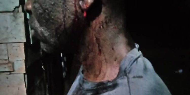 Radio presenter attacked by panga panga-wielding gangsters