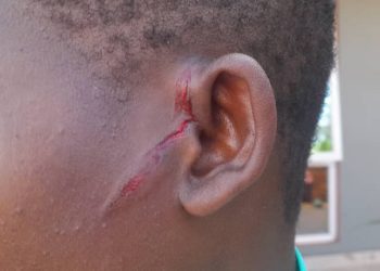 Teargas canister flung at Jinja female journalist in Bobi Wine procession to Kamuli