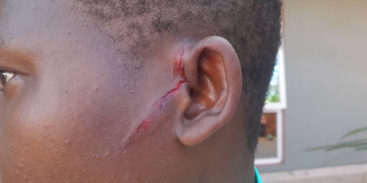 Teargas canister flung at Jinja female journalist in Bobi Wine procession to Kamuli