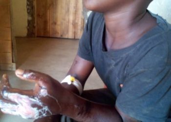 Namayingo: Father burns daughter’s hands after asking him school fees, arrested