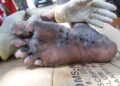 “We Don’t Have Medicines”: Jiggers Ravage a Landing Site In Apac, Over 160 Affected