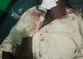 Buwenge Wife, Lover Beat Husband To Near Death After He Finds Them In Marital Bed Making Love