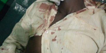 Buwenge Wife, Lover Beat Husband To Near Death After He Finds Them In Marital Bed Making Love