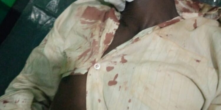 Buwenge Wife, Lover Beat Husband To Near Death After He Finds Them In Marital Bed Making Love